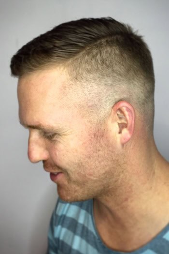 High Skin Fade with a Short Textured Top, side view.
